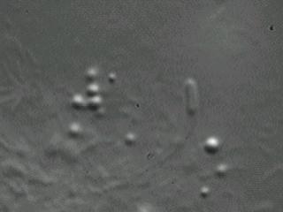 ActinTail-Listeria