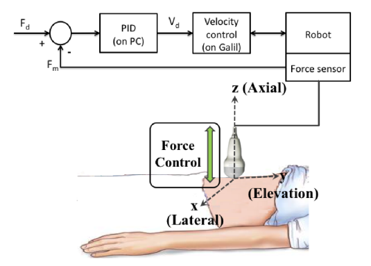 photoacoustic imaging of brachytherapy seeds