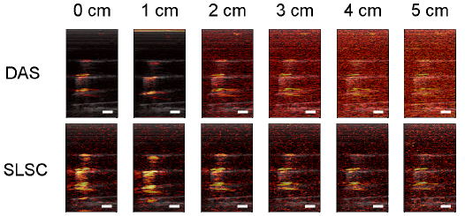 SLSC of photoacoustic images